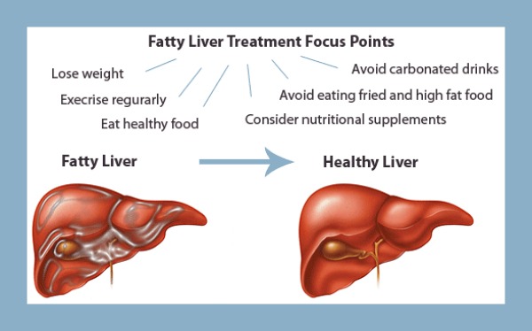 Fatty-Liver-Treatment-600